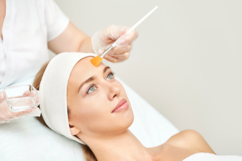 Chemical Peel